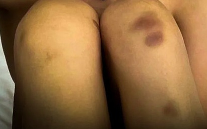 Kisah Turis China di Maldives, Merasa Dilecehkan Staff Hotel Tapi Ia yang Diusir