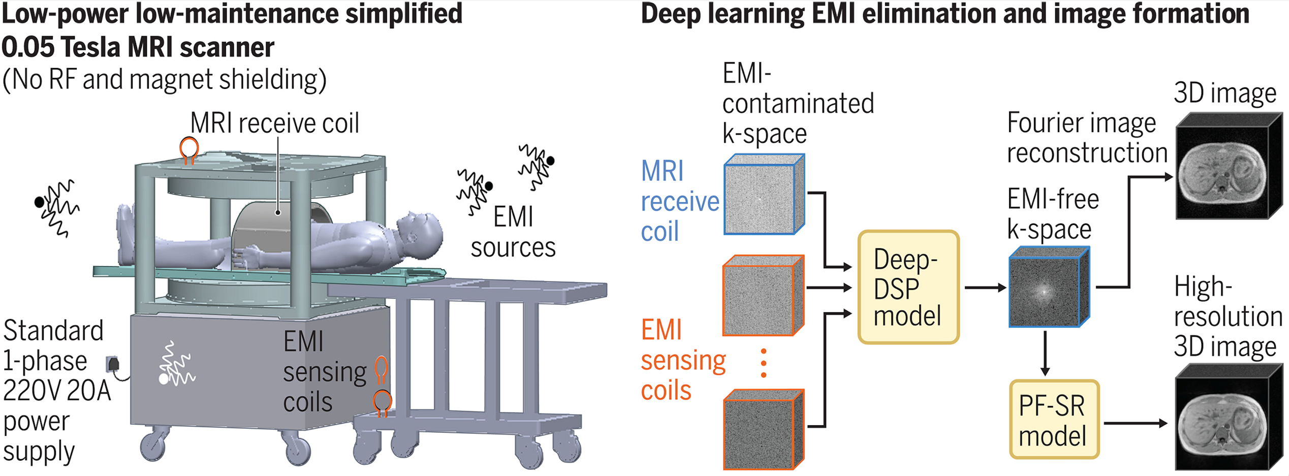 Breakthrough in 0.05 Tesla MRI reported by HKU Engineering team in Science Journal